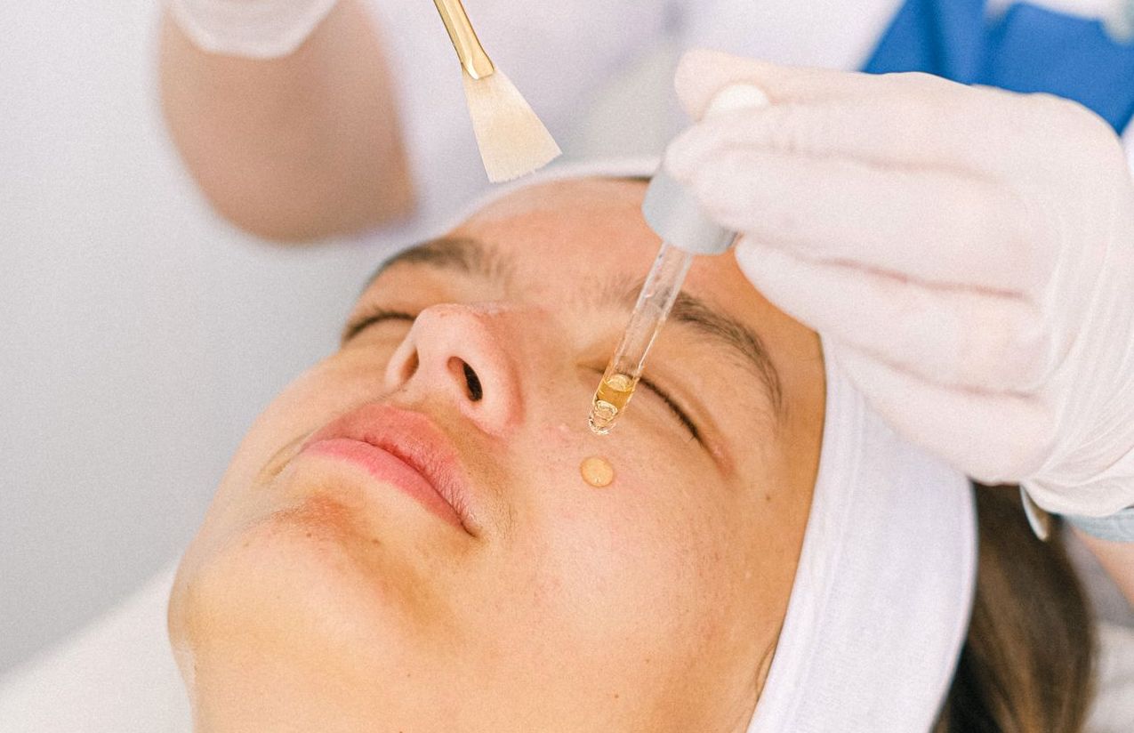 Chemical peel