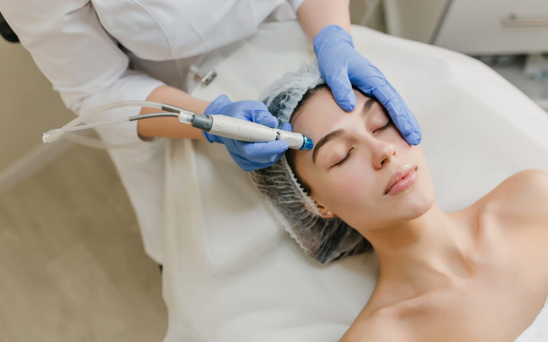 Microdermabrasion ou peeling chimique : lequel choisir?