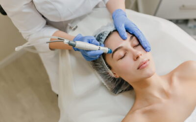 Microdermabrasion vs Chemical Peel: Which Is Better?